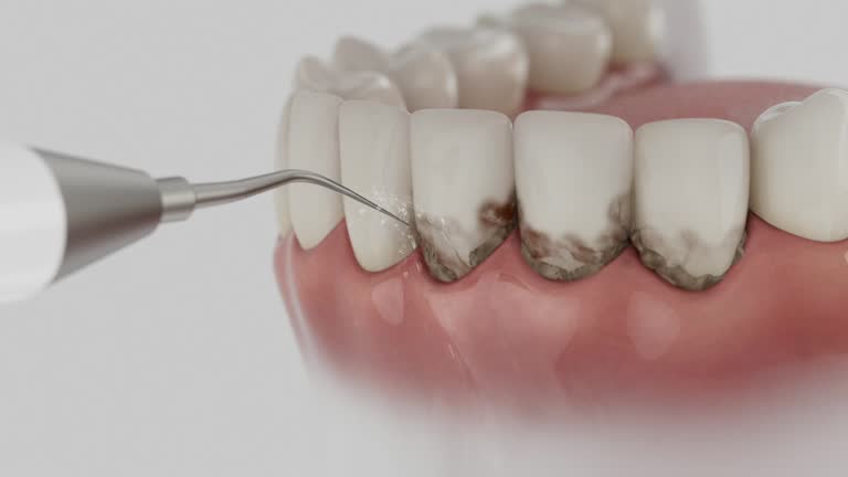 Trusted Root Canal Treatment service in Sperry, OK - Dentist Open Now